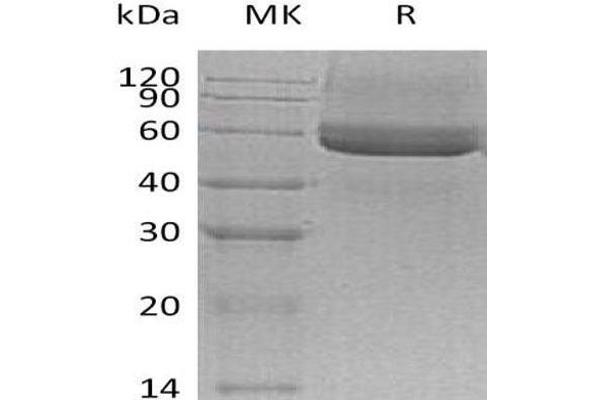 SPOCK3 Protein (His tag)