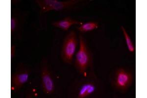 Immunofluorescence staining of methanol-fixed Hela cells using ATF2(Phospho-Thr69 or 51) Antibody. (ATF2 antibody  (pThr69))
