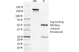SDS-PAGE Analysis Purified BCL-6 Mouse Monoclonal Antibody (BCL6/1526). (BCL6 antibody  (AA 256-389))