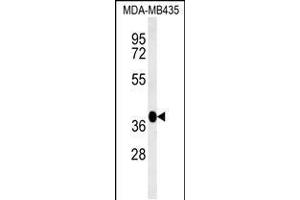 FBXL14 抗体  (C-Term)