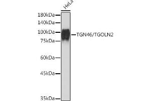 Western blot analysis of extracts of HeLa cells, using TGN46/TGOLN2 Rabbit mAb (ABIN7270875) at 1:1000 dilution. (TGOLN2 antibody)
