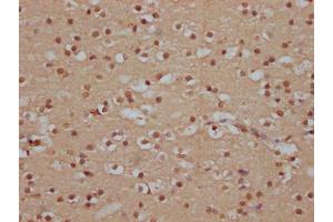 IHC image of ABIN7127821 diluted at 1:100 and staining in paraffin-embedded human brain tissue performed on a Leica BondTM system. (Recombinant SOX1 antibody)