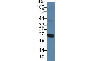 Western Blot; Sample: Mouse Eye lysate; Primary Ab: 2µg/ml Rabbit Anti-Human RCVRN Antibody Second Ab: 0. (Recoverin antibody  (AA 2-200))