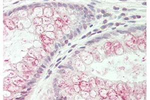 Rabbit Anti-WNK3 antibody  Formalin Fixed Paraffin Embedded Tissue: Human Colon Primary antibody Concentration: 1:100 Secondary Antibody: Donkey anti-Rabbit-Cy3 Secondary Antibody Concentration: 1:200 Magnification: 20x Exposure Time: 0. (WNK3 antibody  (N-Term))