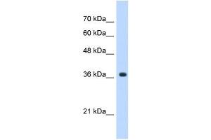 A4GNT antibody used at 0. (A4GNT antibody  (C-Term))