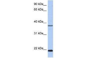 HDDC3 antibody used at 1 ug/ml to detect target protein. (HDDC3 antibody  (Middle Region))