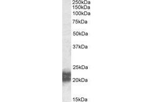 Western Blotting (WB) image for anti-Niemann-Pick Disease, Type C2 (NPC2) (AA 18-31) antibody (ABIN490668) (NPC2 antibody  (AA 18-31))