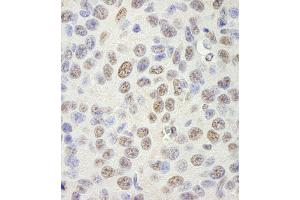 anti-KH Domain Containing, RNA Binding, Signal Transduction Associated 1 (KHDRBS1) (AA 1-50) antibody