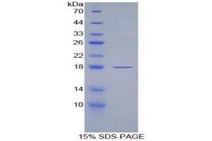SDS-PAGE (SDS) image for Peroxiredoxin 2 (PRDX2) (AA 6-164) protein (His tag) (ABIN1877332) (Peroxiredoxin 2 Protein (PRDX2) (AA 6-164) (His tag))