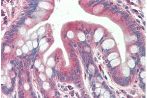 Human, Small intestine: Formalin-Fixed Paraffin-Embedded (FFPE) (TXNDC11 antibody  (AA 114-126))