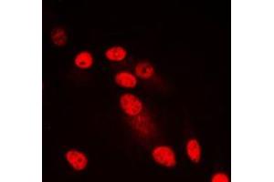 Immunofluorescent analysis of SYNE3 staining in HepG2 cells. (Nesprin3 antibody  (Center))