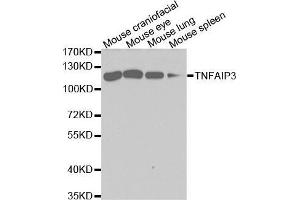 Western blot analysis of extracts of various cell lines, using TNFAIP3 antibody. (TNFAIP3 antibody  (AA 1-190))