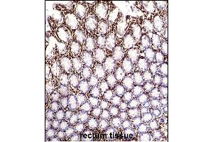 VIME Antibody (ABIN652639 and ABIN2842429) immunohistochemistry analysis in formalin fixed and paraffin embedded human rectum tissue followed by peroxidase conjugation of the secondary antibody and DAB staining. (Vimentin antibody)
