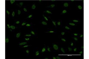 Immunofluorescence of monoclonal antibody to PROX1 on HeLa cell. (PROX1 antibody  (AA 638-737))