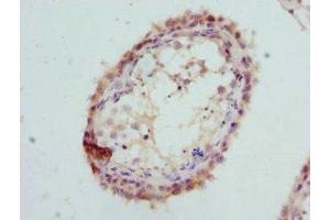 Immunohistochemistry of paraffin-embedded human testis tissue using ABIN7154163 at dilution of 1:100 (GPD2 antibody  (AA 25-325))