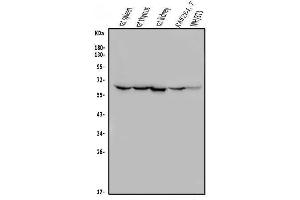 Western blot analysis of ME2 using anti-ME2 antibody (ABIN7600967). (NAD-ME antibody  (AA 26-584))