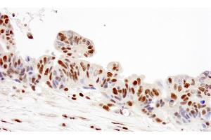 Immunohistochemistry (IHC) image for anti-Replication Protein A2, 32kDa (RPA2) (C-Term) antibody (ABIN7449012) (RPA2 antibody  (C-Term))