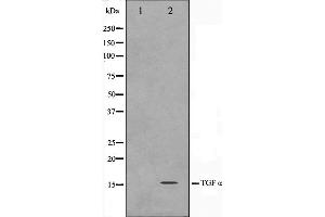 Western blot analysis on COS7 cell lysate using TGF alpha Antibody,The lane on the left is treated with the antigen-specific peptide. (TGFA antibody)