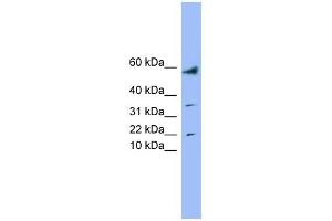 LYRM1 antibody used at 1 ug/ml to detect target protein. (LYRM1 antibody  (Middle Region))