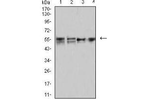 Western blot analysis using CD2 mouse mAb against MOLT4 (1), MCF-7 (2), Hela (3), and L1210 (4) cell lysate. (CD2 antibody  (AA 25-140))