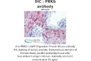 Image no. 2 for anti-PRKG antibody (ABIN1738352) (PRKG antibody)