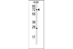 Image no. 1 for anti-Diacylglycerol Kinase, alpha 80kDa (DGKA) (C-Term) antibody (ABIN360612)