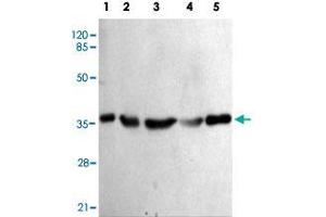 Western blot analysis of PPP1CA monoclonal antibody  at 1 : 1000 dilution. (PPP1CA antibody)