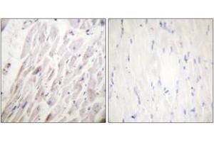 Immunohistochemistry analysis of paraffin-embedded human heart, using Dematin (Phospho-Ser403) Antibody. (Dematin antibody  (pSer403))