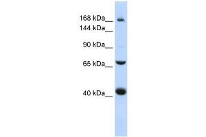 ABCC9 antibody used at 1 ug/ml to detect target protein. (ABCC9 antibody)