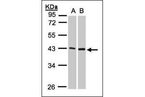 Sample (30 µg whole cell lysate). (MMP3 antibody  (Ser373))