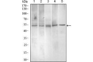 Western blot analysis using PAX3 mouse mAb against A549 (1), A431 (2), Jurkat (3), Rat spleen (4) and Mouse liver (5) cell lysate.