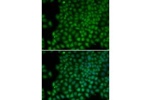 Immunofluorescence analysis of HeLa cells using POLR1C antibody. (POLR1C antibody)
