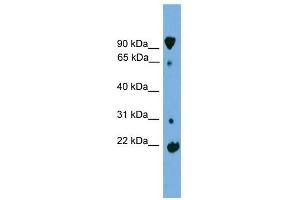 KLHL2 antibody used at 1 ug/ml to detect target protein. (KLHL2 antibody)