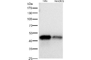 All lanes use the Antibody at 1:1K dilution for 1 hour at room temperature. (Recombinant NFkB antibody)