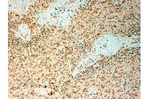 ABIN571057 (4µg/ml) staining of paraffin embedded Human Spleen. (TET2 antibody  (Internal Region))