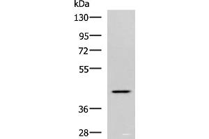 Western blot analysis of Hela cell lysate using SYT2 Polyclonal Antibody at dilution of 1:800 (SYT2 antibody)
