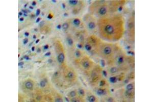 IHC-P analysis of Liver tissue, with DAB staining. (CD2AP antibody  (AA 149-429))