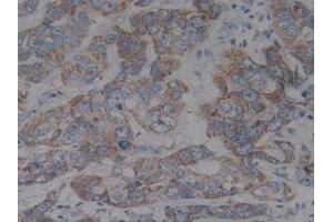 Detection of IkBb in Human Liver Tissue using Polyclonal Antibody to Inhibitory Subunit Of NF Kappa B Beta (IkBb) (Inhibitory Subunit of NF kappa B beta (AA 85-332) antibody)