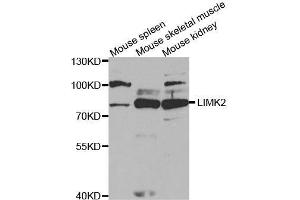 Western blot analysis of extracts of various cell lines, using LIMK2 antibody. (LIMK2 antibody  (AA 1-240))