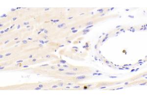 Detection of SDHA in Mouse Cardiac Muscle Tissue using Polyclonal Antibody to Succinate Dehydrogenase Complex Subunit A (SDHA) (SDHA antibody  (AA 4-300))