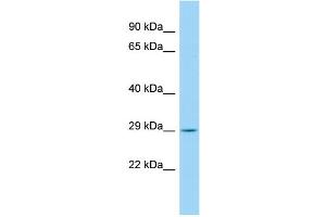 Host: Rabbit Target Name: CCDC134 Sample Type: Fetal Kidney lysates Antibody Dilution: 1. (CCDC134 antibody  (C-Term))