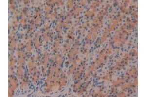 DAB staining on IHC-P; Samples: Rat Stomach Tissue (Fibrillin 1 antibody  (AA 1475-1638))