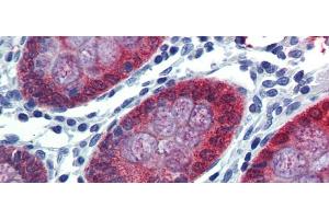 Rabbit Anti-HOXC8 Antibody Catalog Number: arp39557 Paraffin Embedded Tissue: Human Colon Antibody Concentration: 5 ug/ml