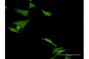 Immunofluorescence of purified MaxPab antibody to HABP4 on HeLa cell. (HABP4 antibody  (AA 1-308))
