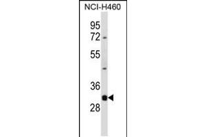 Western blot analysis in NCI-H460 cell line lysates (35ug/lane). (DNASE1L3 antibody  (N-Term))