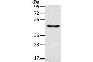 Western blot analysis of Human fetal brain tissue, using SLC16A8 Polyclonal Antibody at dilution of 1:200 (MCT3 antibody)