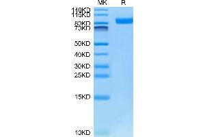 Neuropilin 1 Protein (NRP1) (AA 22-644) (His tag)