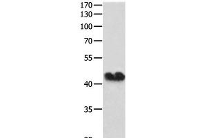 Western Blot analysis of Hela cell using Connexin 43 Polyclonal Antibody at dilution of 1:250 (Connexin 43/GJA1 antibody)