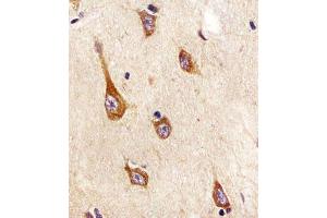(ABIN652381 and ABIN2841827) staining TrkA in human brain tissue sections by Immunohistochemistry (IHC-P - paraformaldehyde-fixed, paraffin-embedded sections).