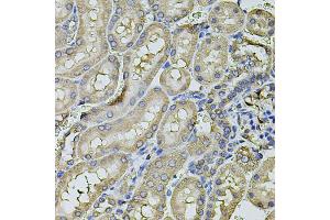 Immunohistochemistry of paraffin-embedded rat kidney using FDX1 antibody. (Ferredoxin1 (FDX1) antibody)